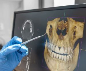 3D Çene Ve Diş Tomografisi